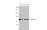 SMARCAL1 Antibody in Western Blot (WB)