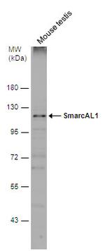 SMARCAL1 Antibody in Western Blot (WB)