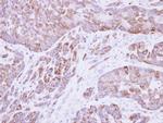 Cytokeratin 8 Antibody in Immunohistochemistry (Paraffin) (IHC (P))