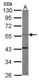 Cytokeratin 8 Antibody in Western Blot (WB)