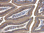 Cytokeratin 8 Antibody in Immunohistochemistry (Paraffin) (IHC (P))