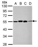 RUVBL1 Antibody in Western Blot (WB)