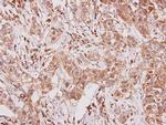 CSF3R Antibody in Immunohistochemistry (Paraffin) (IHC (P))