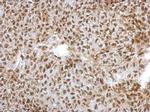 NFYA Antibody in Immunohistochemistry (Paraffin) (IHC (P))