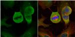 MAD1 Antibody in Immunocytochemistry (ICC/IF)