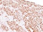 MAD1 Antibody in Immunohistochemistry (Paraffin) (IHC (P))