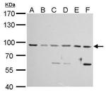 MAD1 Antibody in Western Blot (WB)