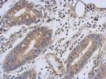 TNNT1 Antibody in Immunohistochemistry (Paraffin) (IHC (P))