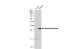 KHK Antibody in Western Blot (WB)