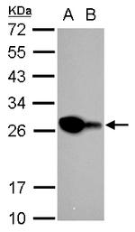 PGP9.5 Antibody in Western Blot (WB)