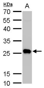 PGP9.5 Antibody in Western Blot (WB)