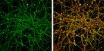 EEA1 Antibody in Immunocytochemistry (ICC/IF)