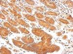 EEA1 Antibody in Immunohistochemistry (Paraffin) (IHC (P))