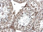 EEA1 Antibody in Immunohistochemistry (Paraffin) (IHC (P))