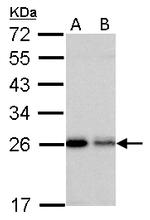 RAB5 Antibody in Western Blot (WB)