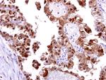 DNA-PK Antibody in Immunohistochemistry (Paraffin) (IHC (P))