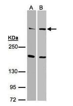 DNA-PK Antibody in Western Blot (WB)