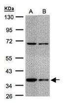 STUB1 Antibody in Western Blot (WB)