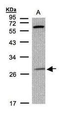 PHOX2B Antibody in Western Blot (WB)