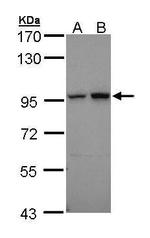 Aconitase 2 Antibody in Western Blot (WB)