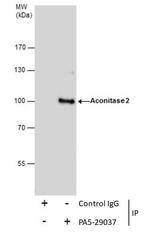 Aconitase 2 Antibody in Immunoprecipitation (IP)