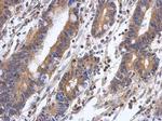 PPM1A Antibody in Immunohistochemistry (Paraffin) (IHC (P))