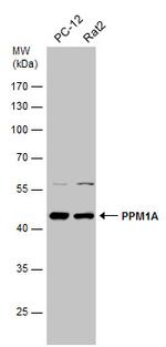 PPM1A Antibody in Western Blot (WB)