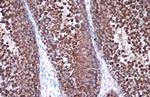 HSP90 alpha Antibody in Immunohistochemistry (Paraffin) (IHC (P))