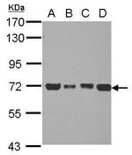 DLAT Antibody in Western Blot (WB)