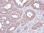 B3GALTL Antibody in Immunohistochemistry (Paraffin) (IHC (P))