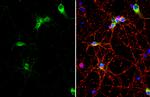 COL6A1 Antibody in Immunocytochemistry (ICC/IF)