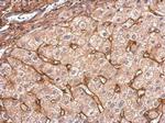 COL6A1 Antibody in Immunohistochemistry (Paraffin) (IHC (P))