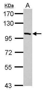 PDE11A Antibody in Western Blot (WB)