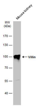 Villin Antibody in Western Blot (WB)