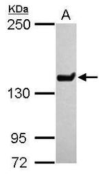 JARID1C Antibody in Western Blot (WB)