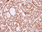 Ku80 Antibody in Immunohistochemistry (Paraffin) (IHC (P))