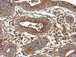 GC Antibody in Immunohistochemistry (Paraffin) (IHC (P))