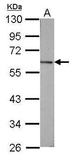 GC Antibody in Western Blot (WB)