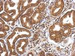 MYO1A Antibody in Immunohistochemistry (Paraffin) (IHC (P))