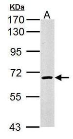 cIAP1 Antibody in Western Blot (WB)