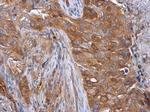 Tara Antibody in Immunohistochemistry (Paraffin) (IHC (P))