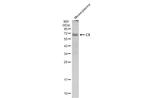 Complement C9 Antibody in Western Blot (WB)