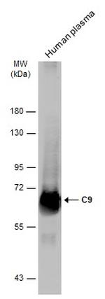 Complement C9 Antibody in Western Blot (WB)