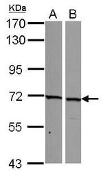 SNW1 Antibody in Western Blot (WB)