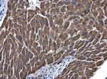 ALDH5A1 Antibody in Immunohistochemistry (Paraffin) (IHC (P))