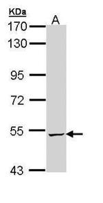 ALDH5A1 Antibody in Western Blot (WB)