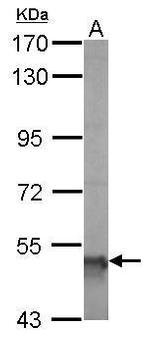 ALDH5A1 Antibody in Western Blot (WB)