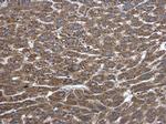 PLA2G4A Antibody in Immunohistochemistry (Paraffin) (IHC (P))