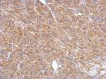 PLA2G4A Antibody in Immunohistochemistry (Paraffin) (IHC (P))