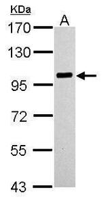 PLA2G4A Antibody in Western Blot (WB)